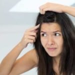 Get Rid of Dandruff Permanently Through Natural Home Remedies