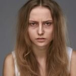 How to Remove Dark Circles Under Eyes