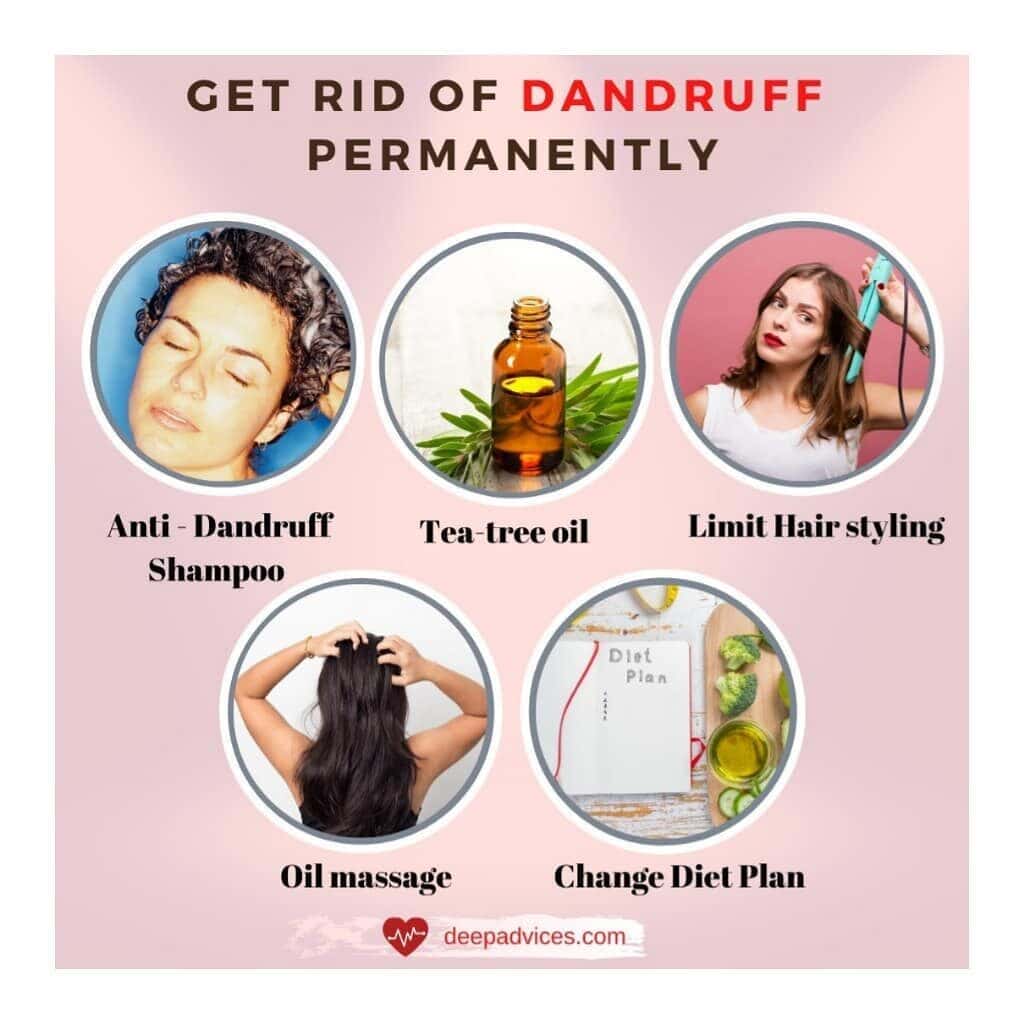 How to Cure Dandruff Permanently Naturally at Home
