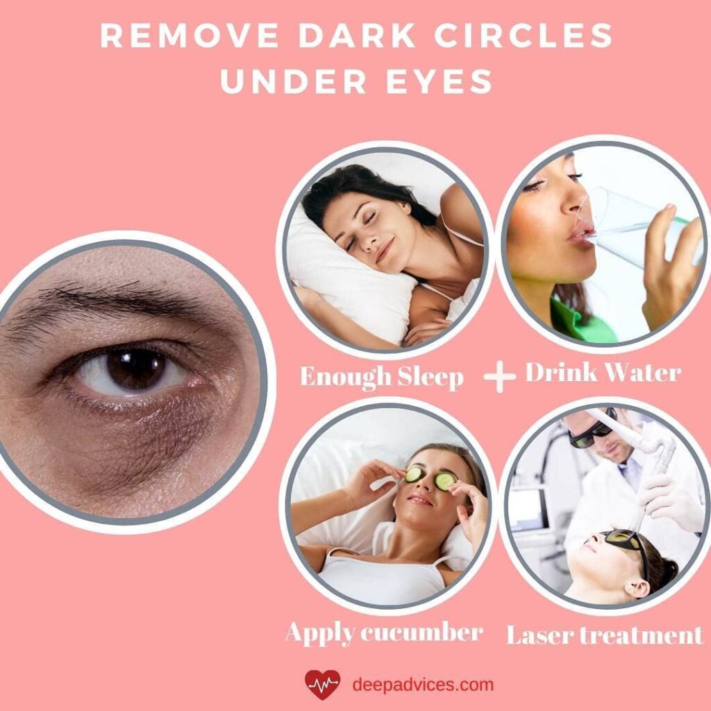 How can you get rid of dark circles under eyes How To Remove Dark Circles Under Eyes Permanently At Home