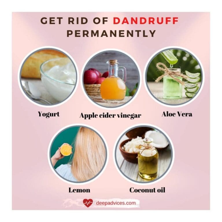 Cure Dandruff Permanently Naturally At Home 768x768 