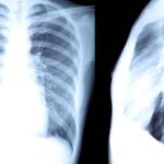 5 Hidden X-Ray Effect On a Human Body