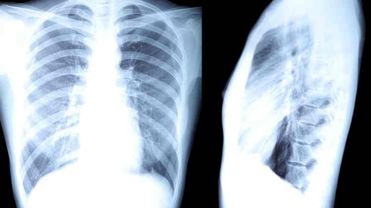 5 Hidden X-Ray Effect On a Human Body