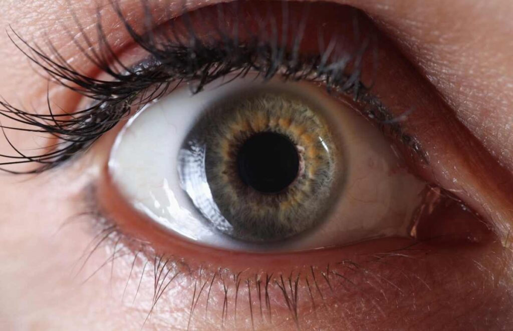 What Is Retinal Detachment?
