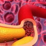 How to Lower Your Cholesterol Levels