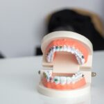 How Much is an Orthodontist in Canada