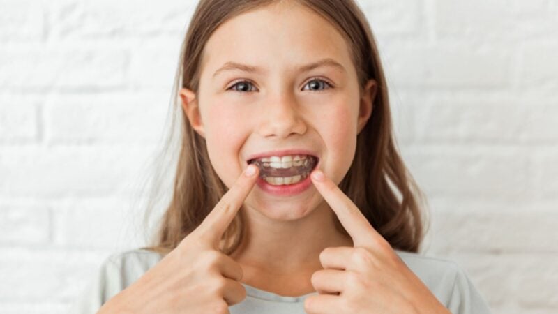 What Age Can a Child Start Invisalign?