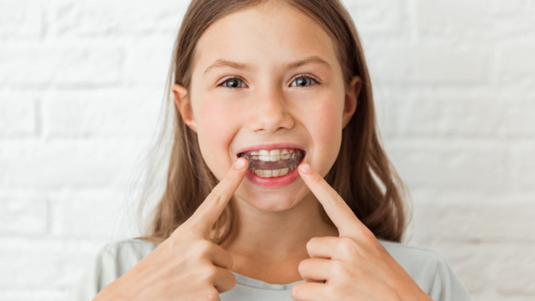 what-age-can-a-child-start-invisalign-deepadvices