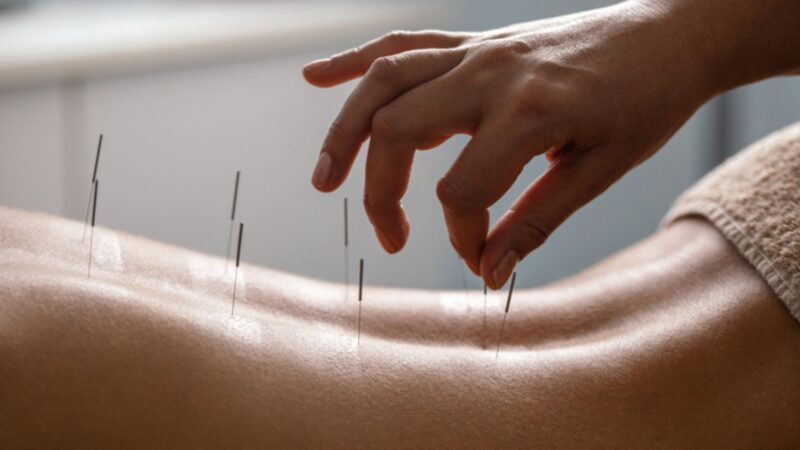 Is Acupuncture Effective For Weight Loss?
