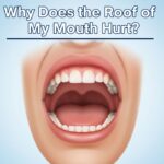 Why Does the Roof of My Mouth Hurt?